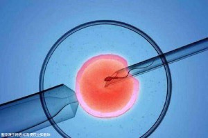 妇科微创